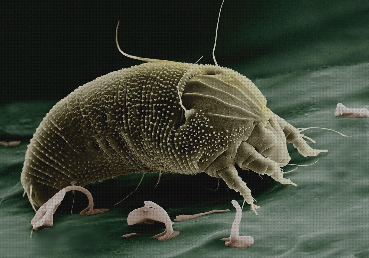 Opiniones de las 1 mejores Alergia Al Dimetil Metacrilato Denttadura