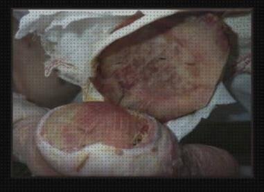 ¿Dónde poder comprar apositos de silicona apositos de silicona sacyl?