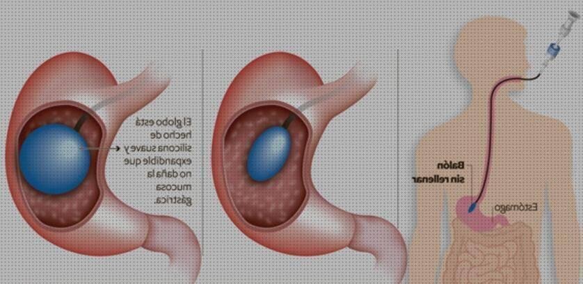 Las mejores Más sobre chupete de silicona chicco Más sobre barra de silicona mac Más sobre bara de silicona balon expandible de silicona