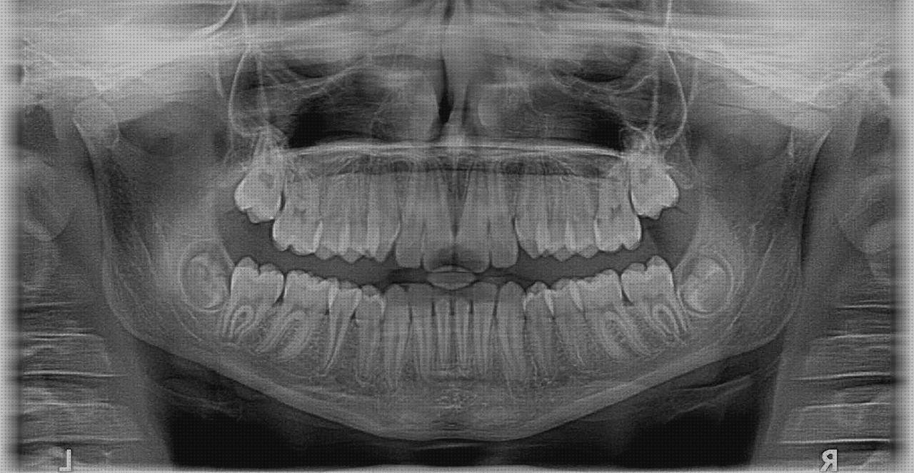 Las mejores marcas de brackets de plástico puños silicona mtb esi grips chunky puños silicona brackets de plástico metalicos