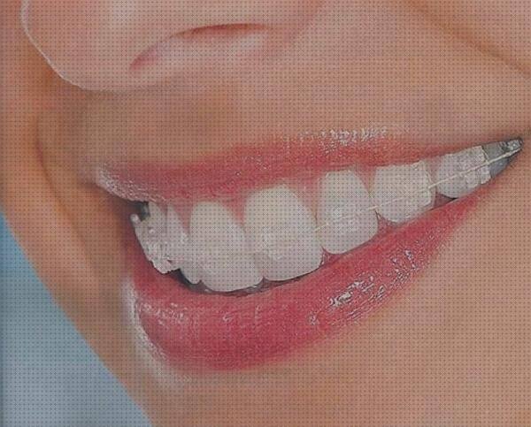 ¿Dónde poder comprar brackets brackets de plastico transparente?