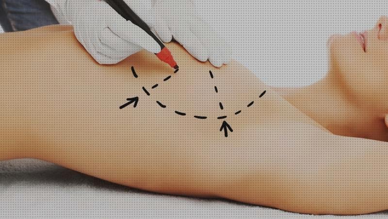 Review de los 12 mejores cirurgia plastica gratuitas
