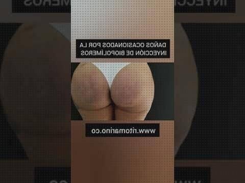 Review de inyeccion de silicona en los gluteos