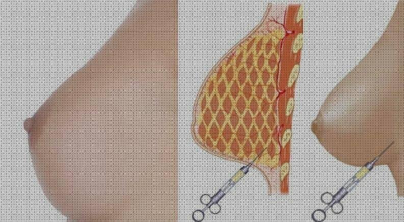 Las mejores marcas de levantamiento de senos sin silicona Más sobre esmalte de uñas de silicona Más sobre gavetero de plástico levantamiento de pecho sin silicona