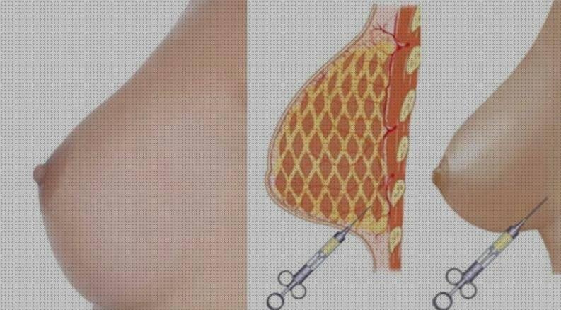 ¿Dónde poder comprar Más sobre esmalte de uñas de silicona Más sobre gavetero de plástico Más sobre gavetero de plástico levantamiento de senos sin silicona?