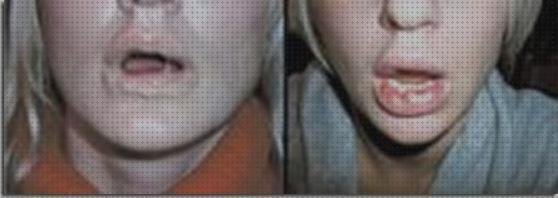 Las mejores marcas de bovedas metacrilato cubricion caja de metacrilato 15x15 bezel metacrilato metacrilato en labios