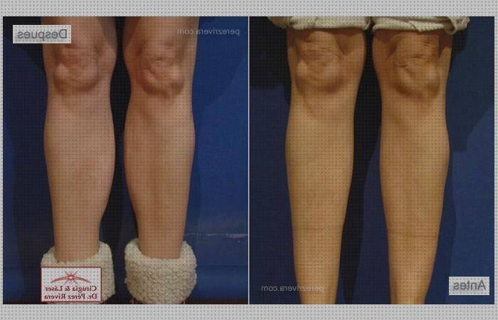 Las mejores marcas de uñas postizas de silicona Más sobre talonera silicona anatomicas Más sobre muñecas de silicona grandes pantorrillas postizas de silicona