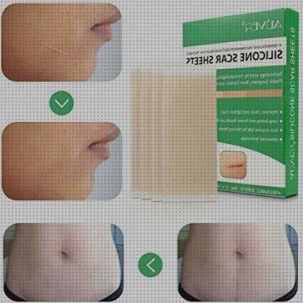 Las mejores marcas de parche silicona cicatriz parche de gel de silicona