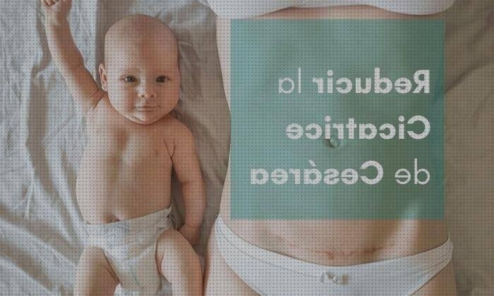 Análisis de los 7 mejores Parches De Siliconas Trofolastin