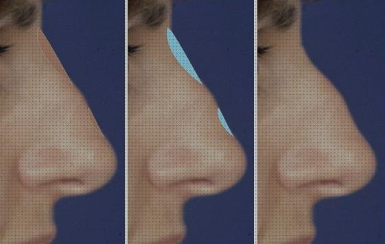 ¿Dónde poder comprar cortal metacrilato panera metacrilato perchero metacrilato rinomodelacion metacrilato?