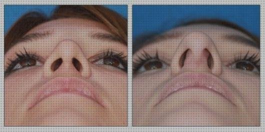 Las mejores marcas de cortal metacrilato panera metacrilato perchero metacrilato rinomodelacion metacrilato