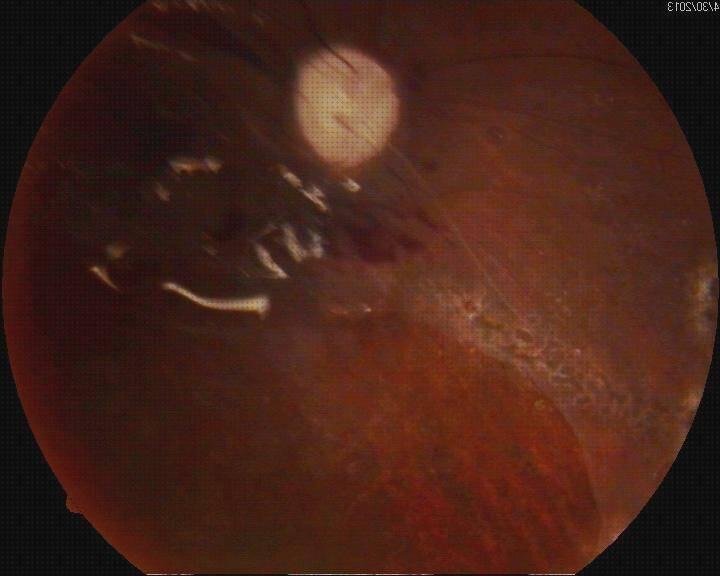 ¿Dónde poder comprar vision con aceite de silicona Más sobre gavetero de plástico Más sobre gavetero de plástico vision ojo con aceite de silicona?